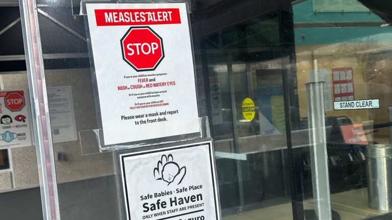 Measles case confirmed in Washington, DC