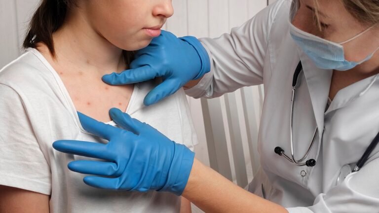 Virginia confirms child infected with first measles case in the state