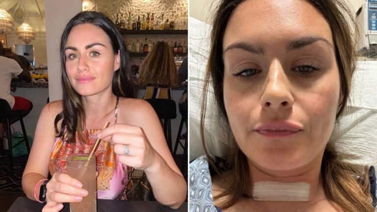 ‘ChatGPT saved my life,’ says mom who survived cancer after doctors missed it