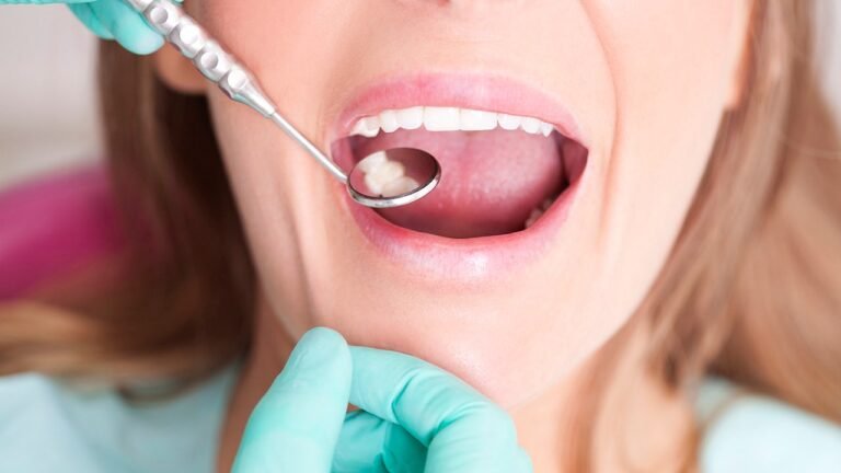 Cavity symptoms, causes and prevention methods for better dental health