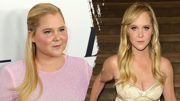 Amy Schumer’s weight loss tied to Cushing’s syndrome — here’s what to know