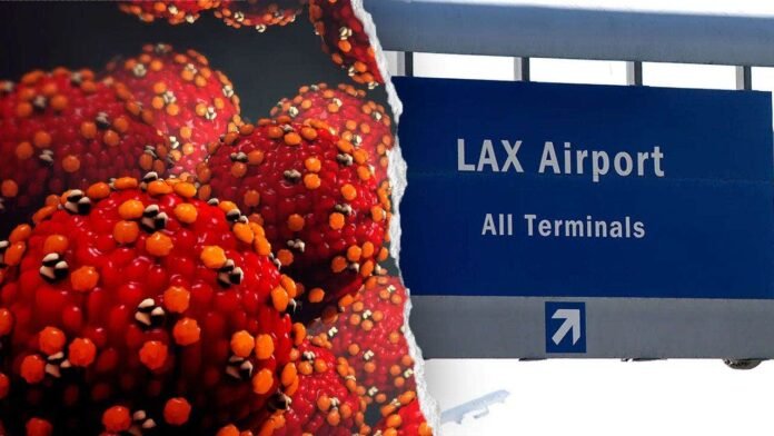 measles-case-in-LA-county.jpeg