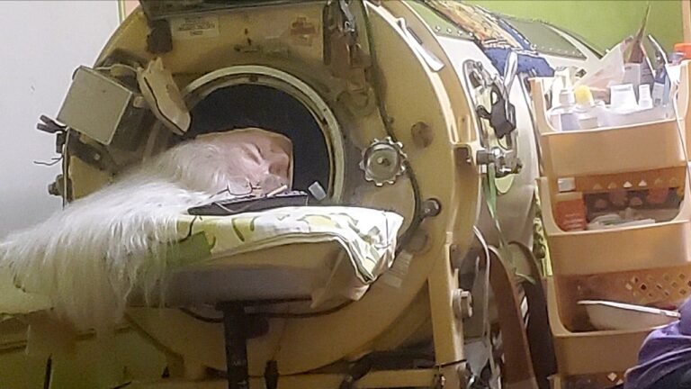 Polio survivor who was last American iron lung user dies at age 78